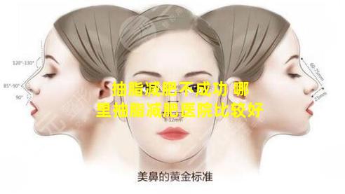 抽脂减肥不成功 哪里抽脂减肥医院比较好